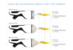 Image de INTELECT FOCAL SHOCKWAVE SET - CHATTANOOGA